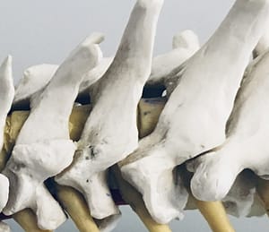 artrosis lumbar